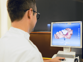 Zirconia Vs. Titanium Dental Implants, which is Better?