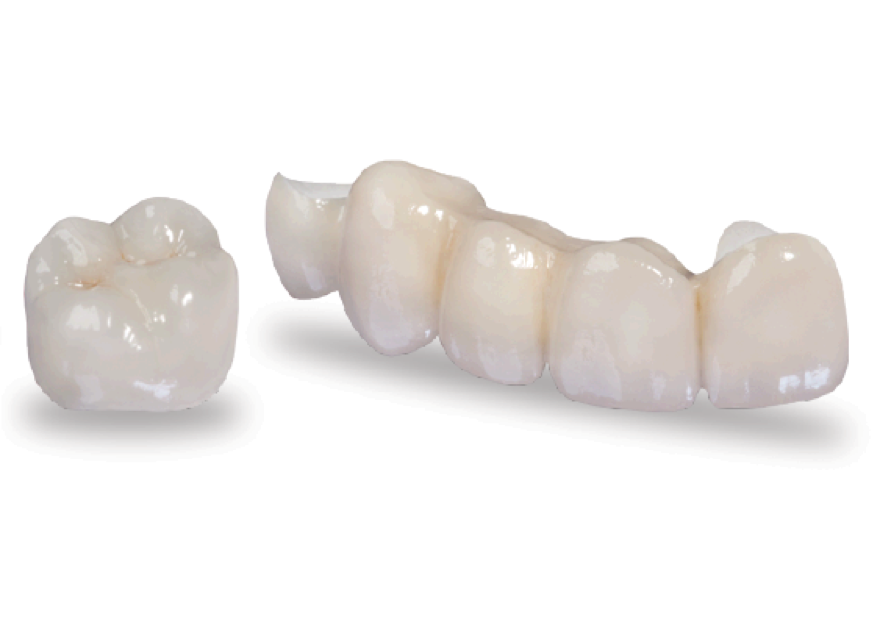 Zirconia Crowns - Dental Lab. Dental Laboratory for Zirconia Crowns.