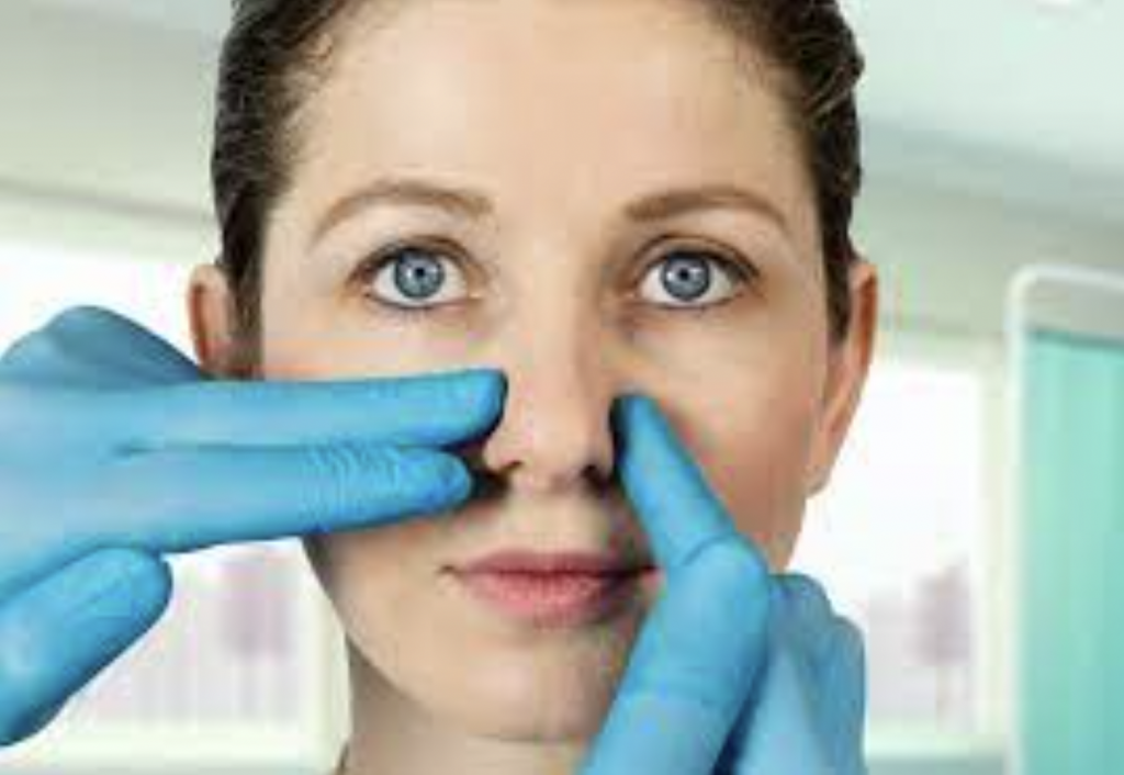 Revision Rhinoplasty & Its Benefits