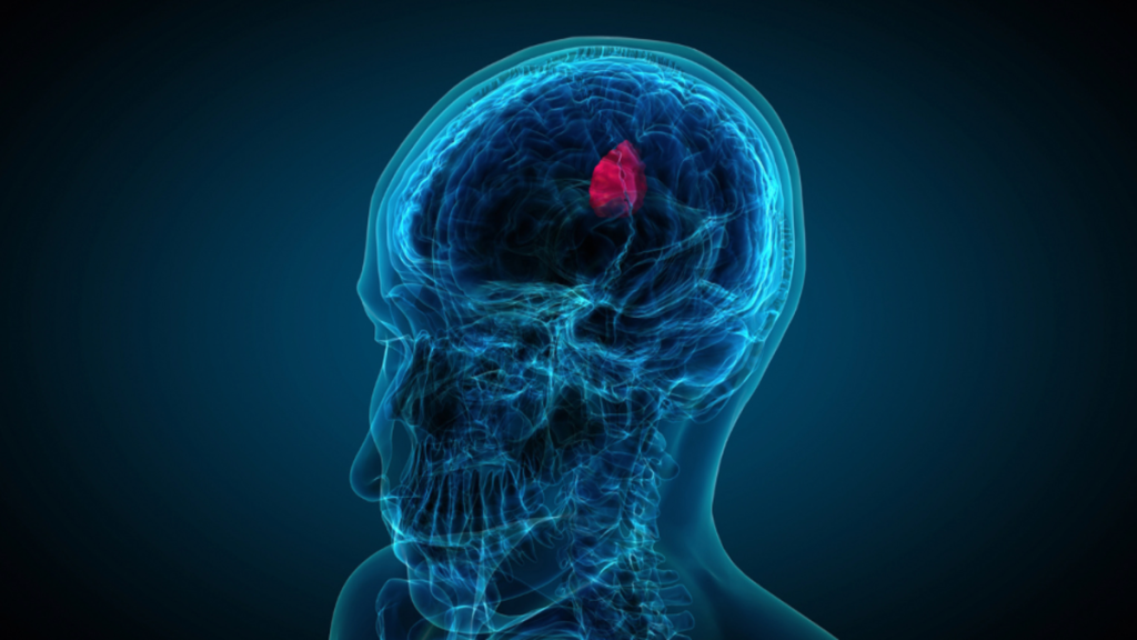 MRI Scan for Back Pain, Brain Issues & More