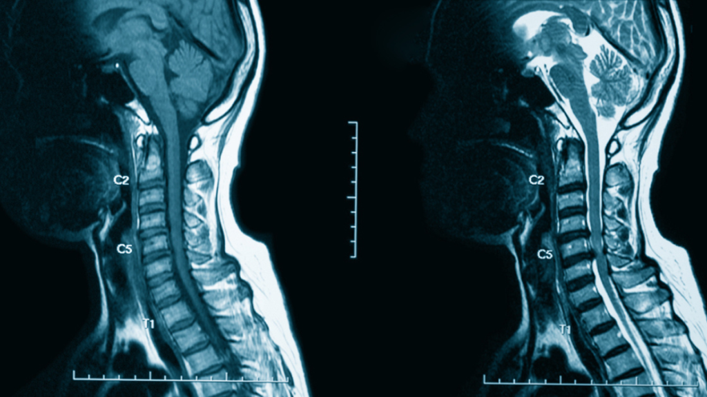 Contrast Media That Matter Why Bracco’s Solutions Set the Standard in MRI and CT