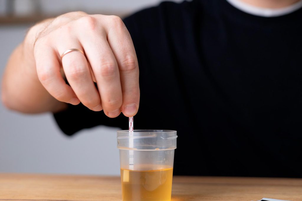 Image 1 of Common Mistakes People Make Before a THC Urine Test (and How to Avoid Them)