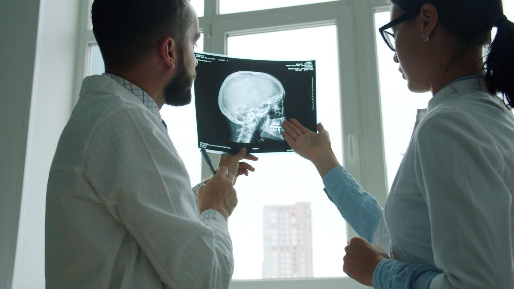 The Invisible Injury: Why Traumatic Brain Injuries Can Go Unrecognized After an Accident Image 1 of The Invisible Injury: Why Traumatic Brain Injuries Can Go Unrecognized After an Accident